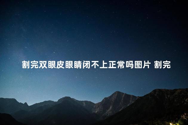 割完双眼皮眼睛闭不上正常吗图片 割完双眼皮眼睛闭不上正常吗